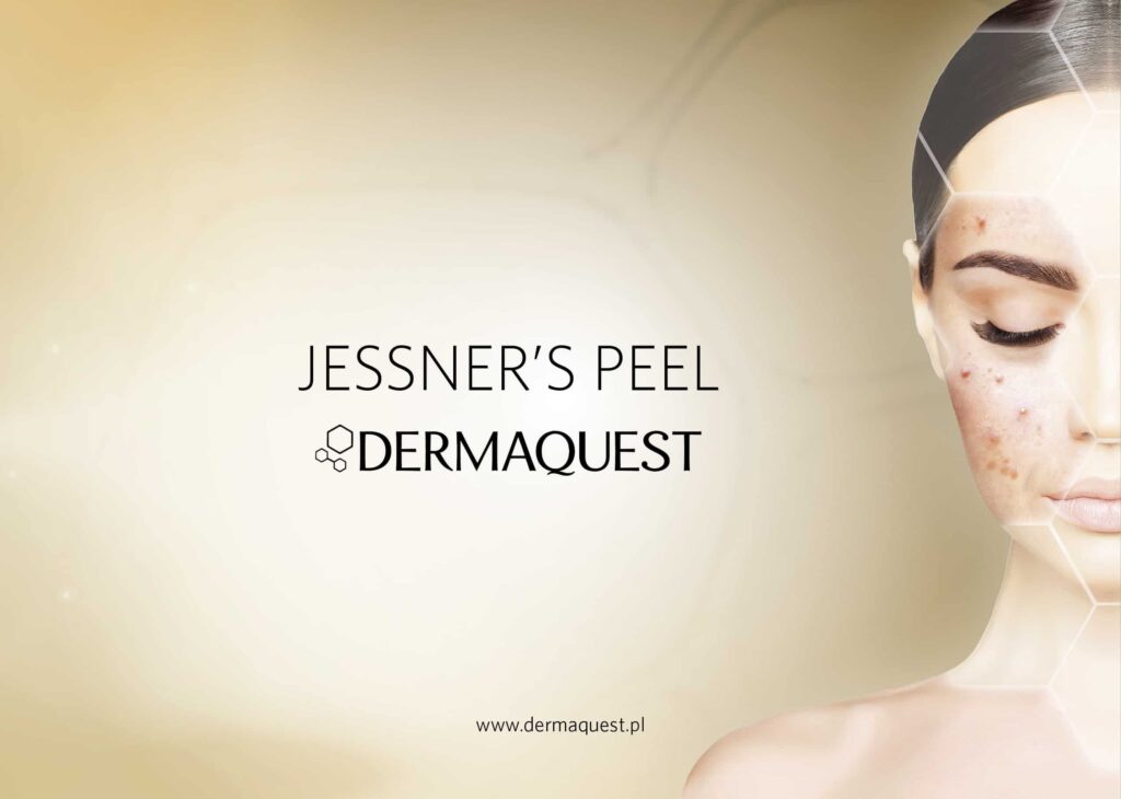 Peeling Jessnera Dermaquest Zabiegi na twarz Olsztyn